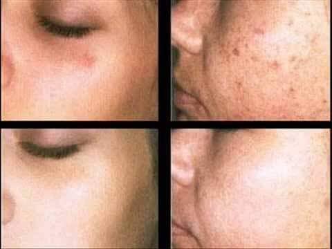 FIRMING VENZEN SUERO REAFIRMANTE ANTIEDAD - Imagen 4